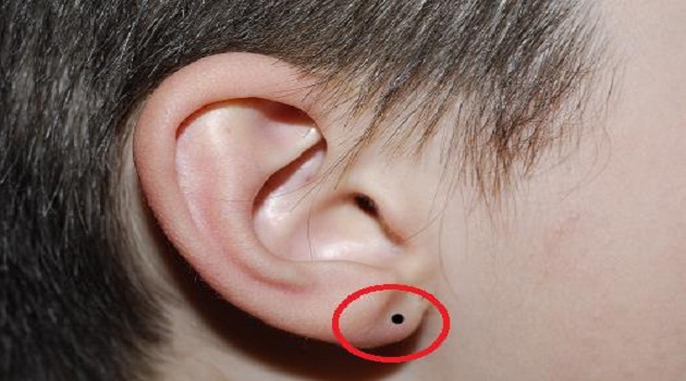 Xem bói nốt ruồi ở tai nói lên điều gì